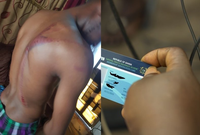 Man Beaten at Kempinski Hotel for Trying to Pay for Food with His National Health Insurance Card